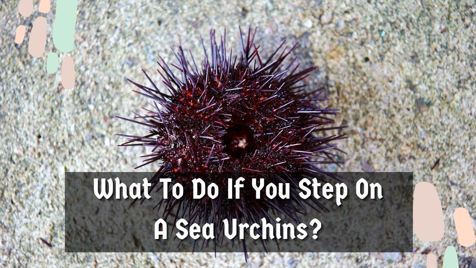 What to Do If You Step on a Sea Urchin 5 Key Steps